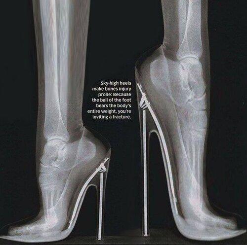 High Heels X-ray